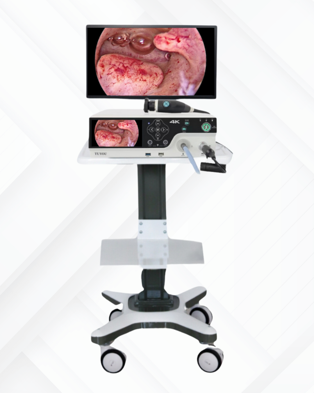 4K Endoscopy