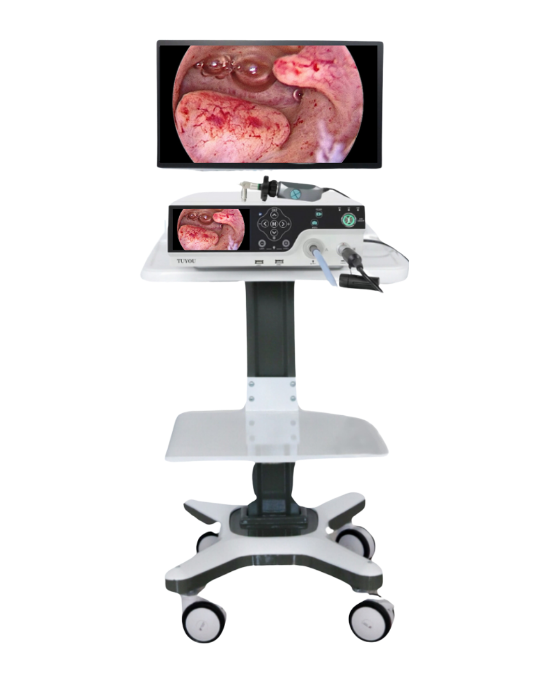 FHD Endoscopy