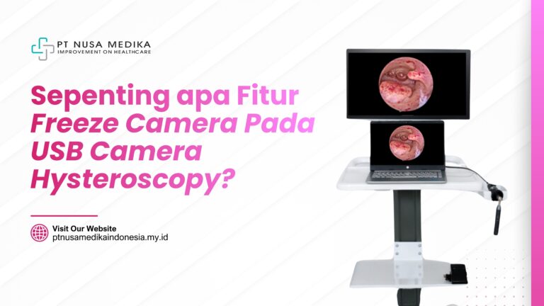 Sepenting apa Freeze Camera pada USB Camera Hysteroscopy?