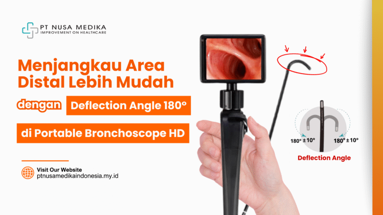 Menjangkau Area Distal Lebih Mudah: Keunggulan Deflection Angle 180° pada Portable Bronchoscope HD
