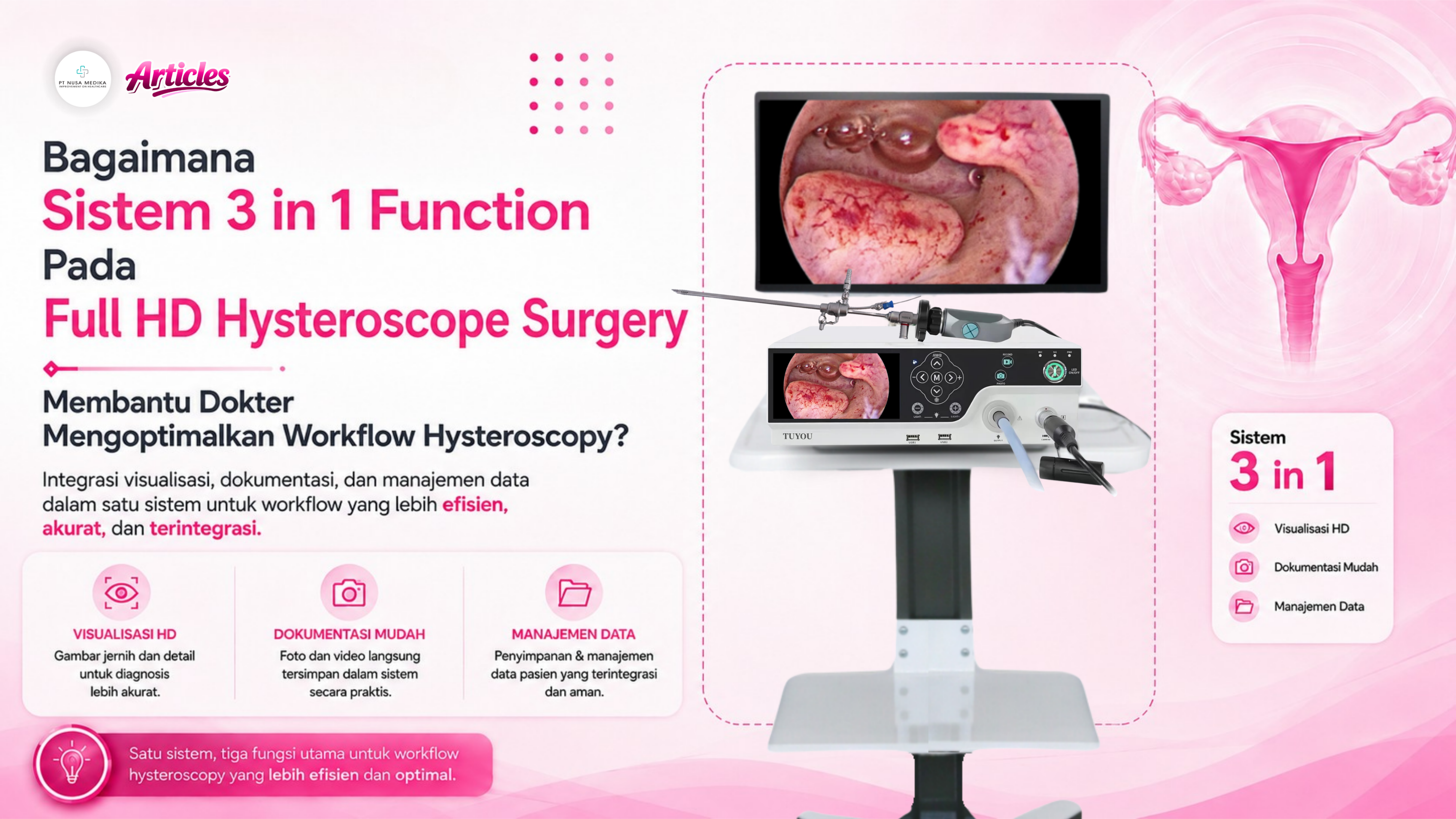Bagaimana Sistem 3 Function in 1 Membantu Dokter Mengoptimalkan Workflow Hysteroscopy?